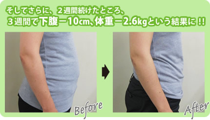 before→after