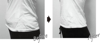 before→after